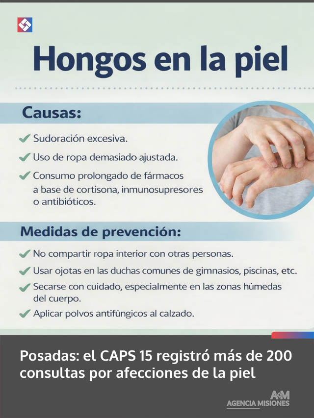 Posadas: el CAPS 15 registró más de 200 consultas por afecciones de la piel