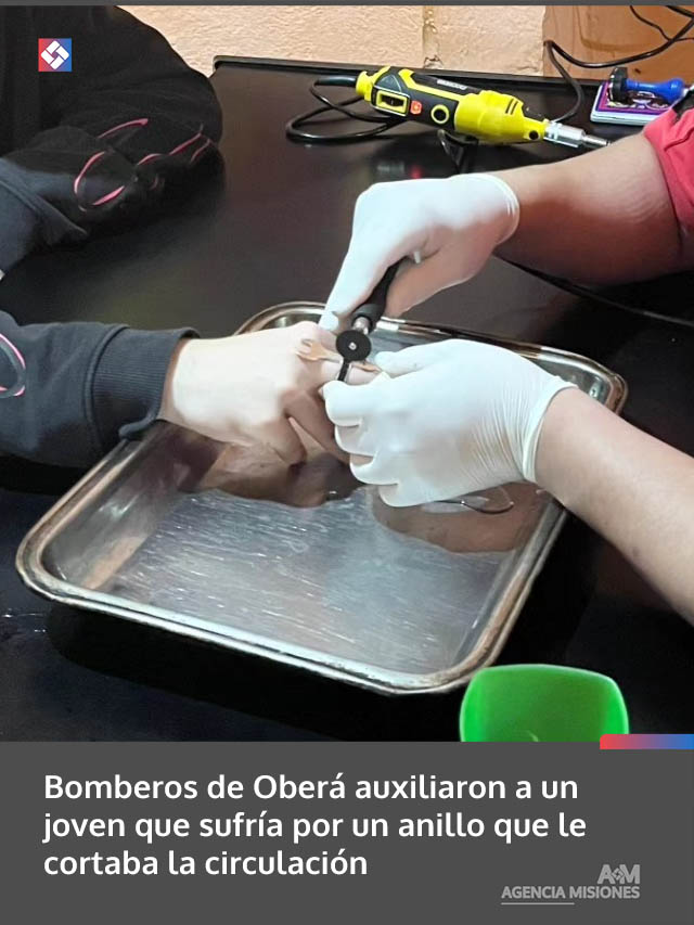 Bomberos de Oberá auxiliaron a un joven que sufría por un anillo que le cortaba la circulación